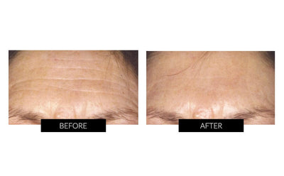 CurrentBody Skin Full Body Anti-ageing Kit