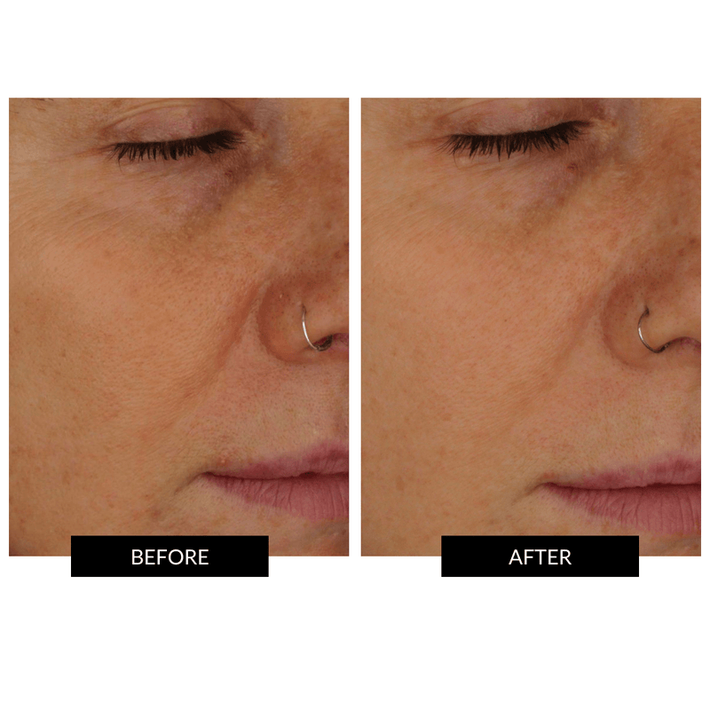 FACEGYM Skin Changer 2in1 Exfoliating EssenceToner (30/100ml