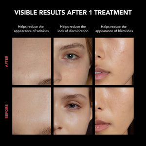 FAQ™ 202 Silicone Mask