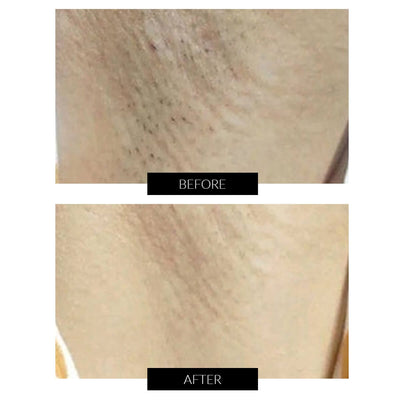 Ulike Sapphire Air+ IPL Hair Removal Device