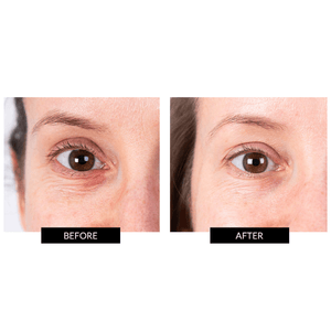 CurrentBody Skin LED Eye Perfector & 5 Eye Hydrogel Masks worth €249